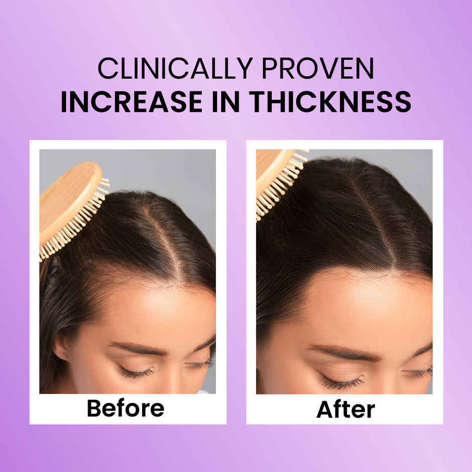 Spring H2O Rosemary Hair Growth Oil