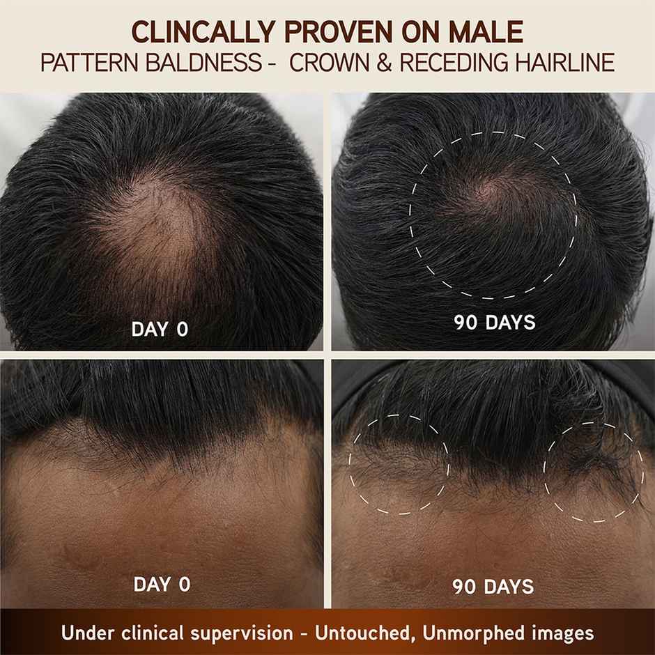 Indulekha Bringha Hair Growth Treatment Scalp Serum |Ayurvedic Hair Growth Serum