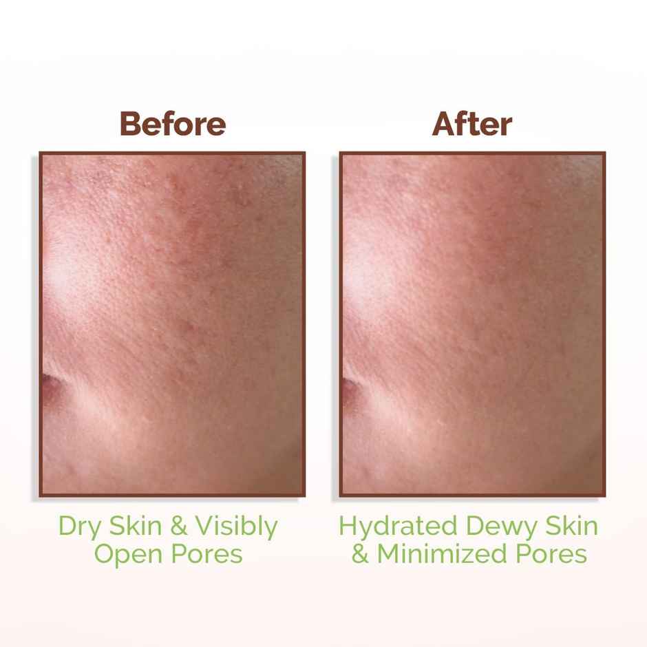 Mamaearth Rice Water Dewy Face Toner With Rice Water & 4% Niacinamide