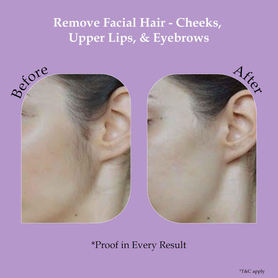 Sanfe Multi-Head Face Razor for Women | Eyebrow & Facial Hair Remover