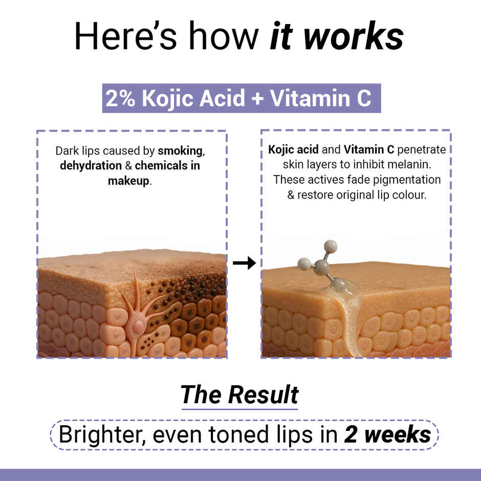 SEREKO Lip Balm for Dark Lips Kojic Acid, Vitamic C & Mango Butter | 24 H Hydration | Affogato