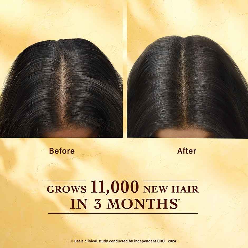 Indulekha Bringha Hair Growth Treatment Scalp Serum | Ayurvedic Hair Growth Serum