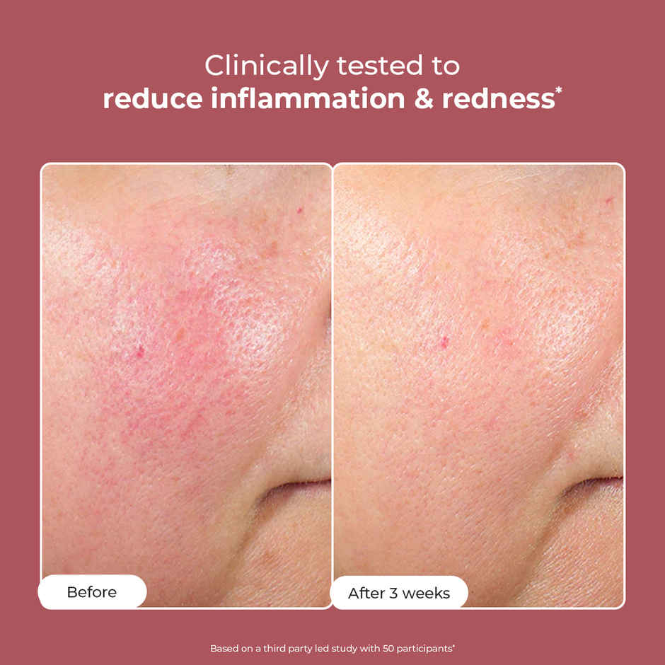 Conscious Chemist 10% Azelaic Acid Face Cream For Redness Relief & Acne Treatment