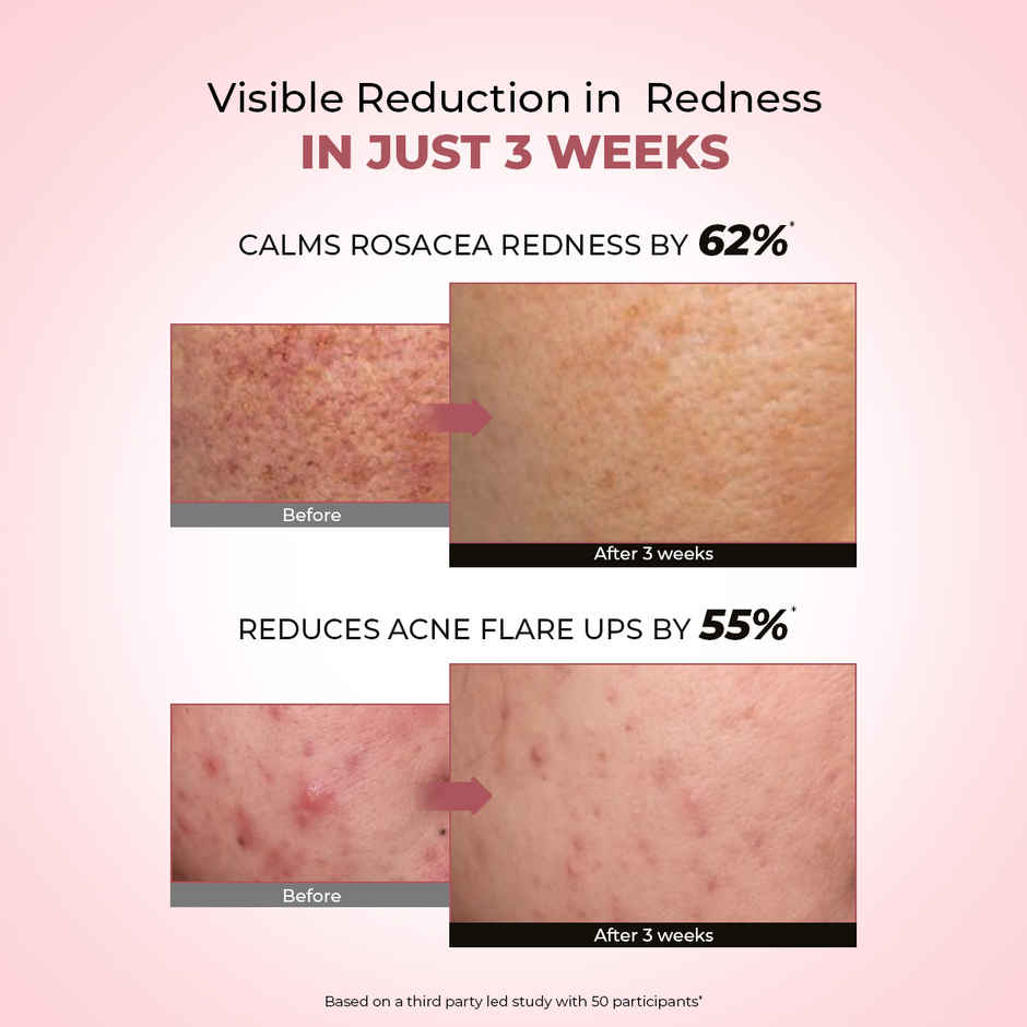 Conscious Chemist 10% Azelaic Acid Face Cream For Redness Relief & Acne Treatment