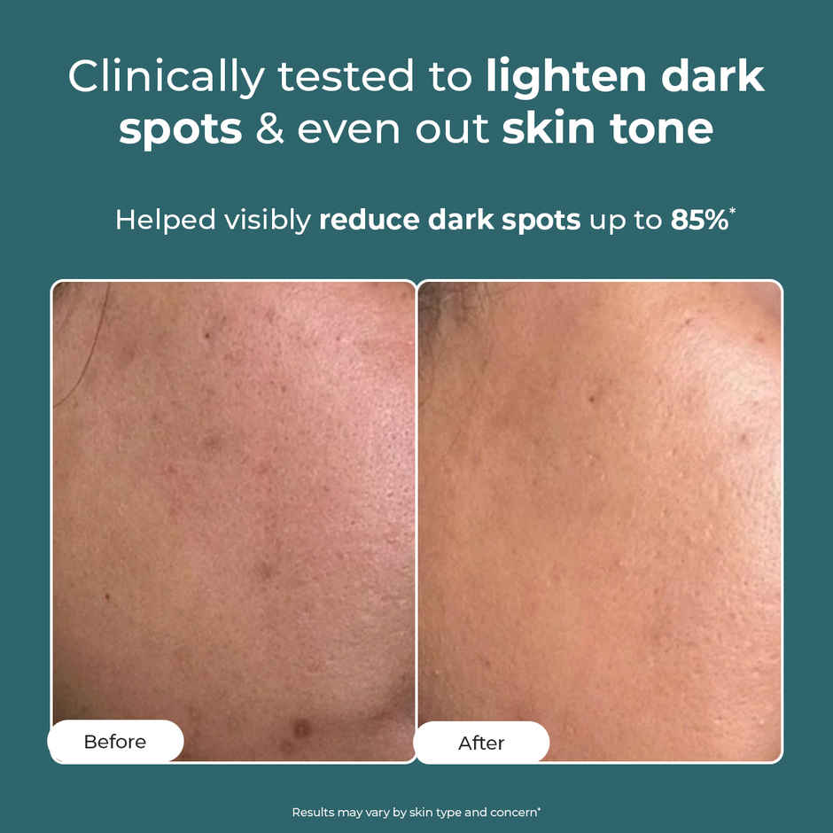 Conscious Chemist Niacinamide Pigmentation Corrector Night Cream Moisturiser For Dark Spots