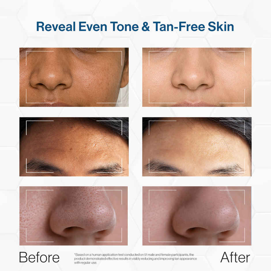 FCL Fixderma De Tan Mask For Tanning & Dark Skin | Cleans Pores | Removes Blackheads | Improves Skin Tone