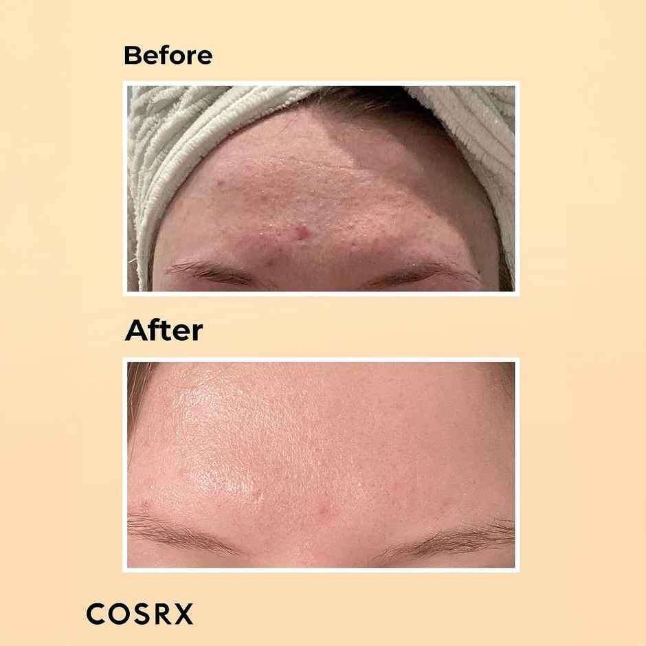 Cosrx Advanced Snail 96 Mucin Power Essence