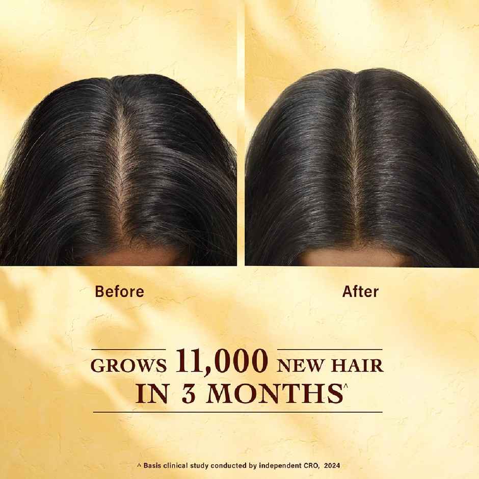 Indulekha Bringha Hair Growth Treatment Scalp Serum |Ayurvedic Hair Growth Serum