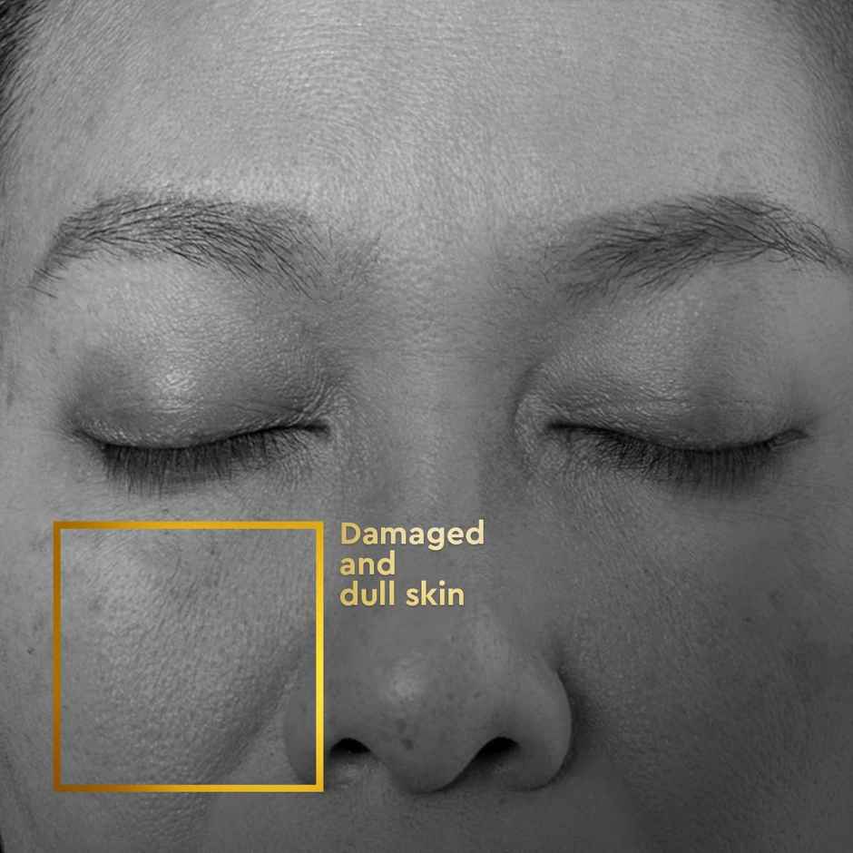 VLCC Clinic Prorescue Micro Serum