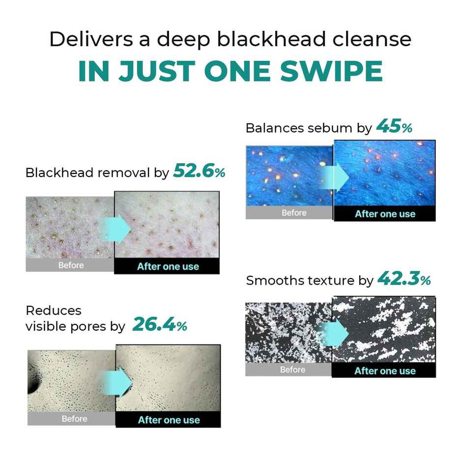 Conscious Chemist Blackhead Melting Water with Succinic & Glycolic Acid for Clear, Smooth Skin