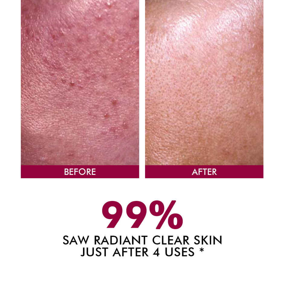 Conscious Chemist 25% AHA & 5% BHA Resurfacing Peeling Exfoliating Facial Serum For Anti-Aging