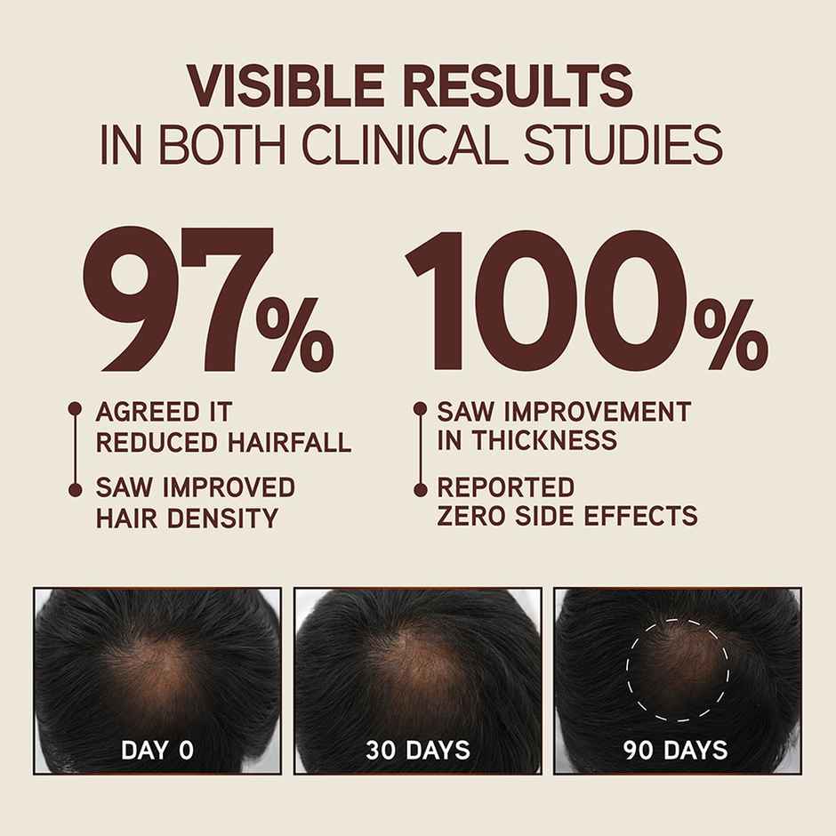 Indulekha Bringha Hair Growth Treatment Scalp Serum |Ayurvedic Hair Growth Serum