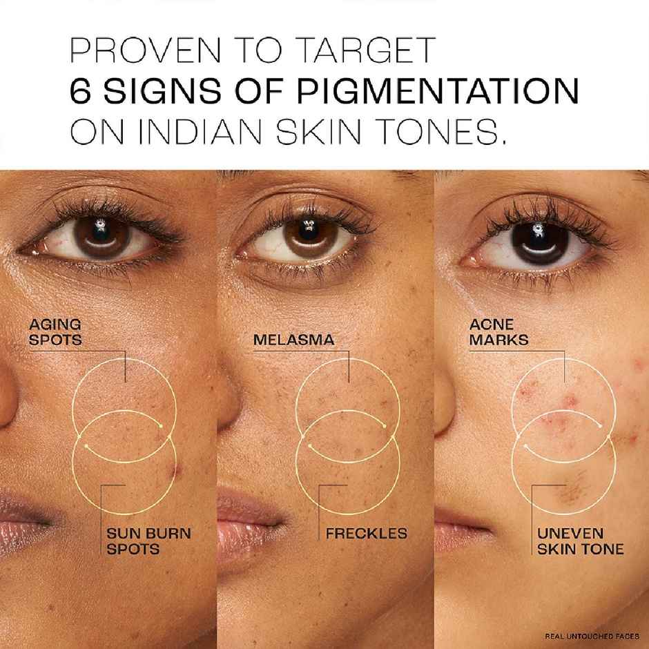 Lakme Perfect Radiance Serum With 15% Niacinamide Resorcinol Pro Retinol Complex