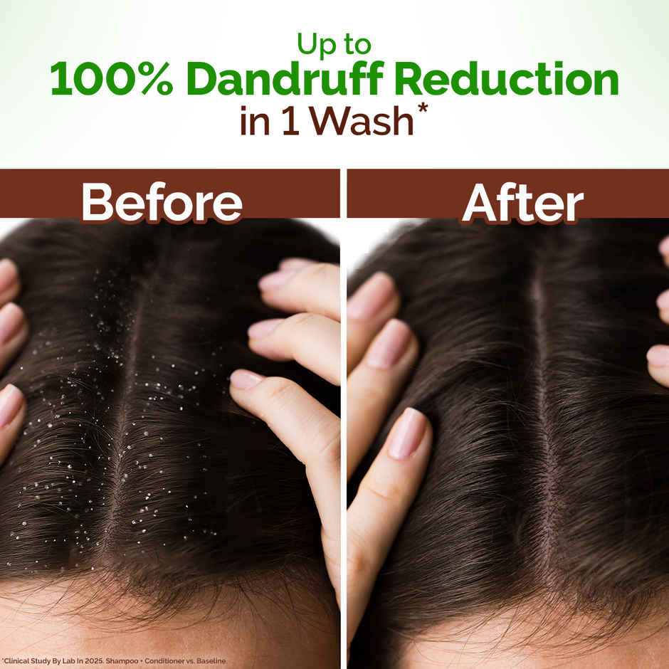 Mamaearth Lemon Anti Dandruff Shampoo With Lemon & Ginger For Itchy & Flaky Scalp