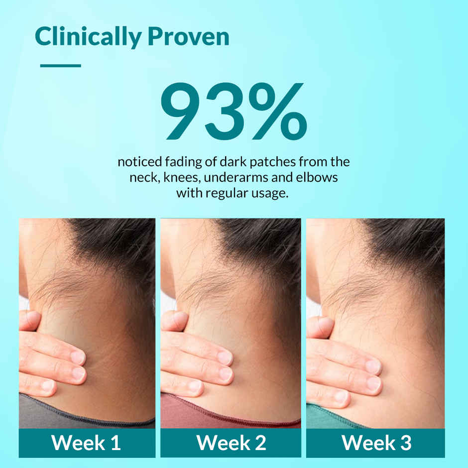 Fixderma Nigrifix Cream for Dark Neck, Elbow & Knee | Underarm Whitening Cream with Lactic Acid