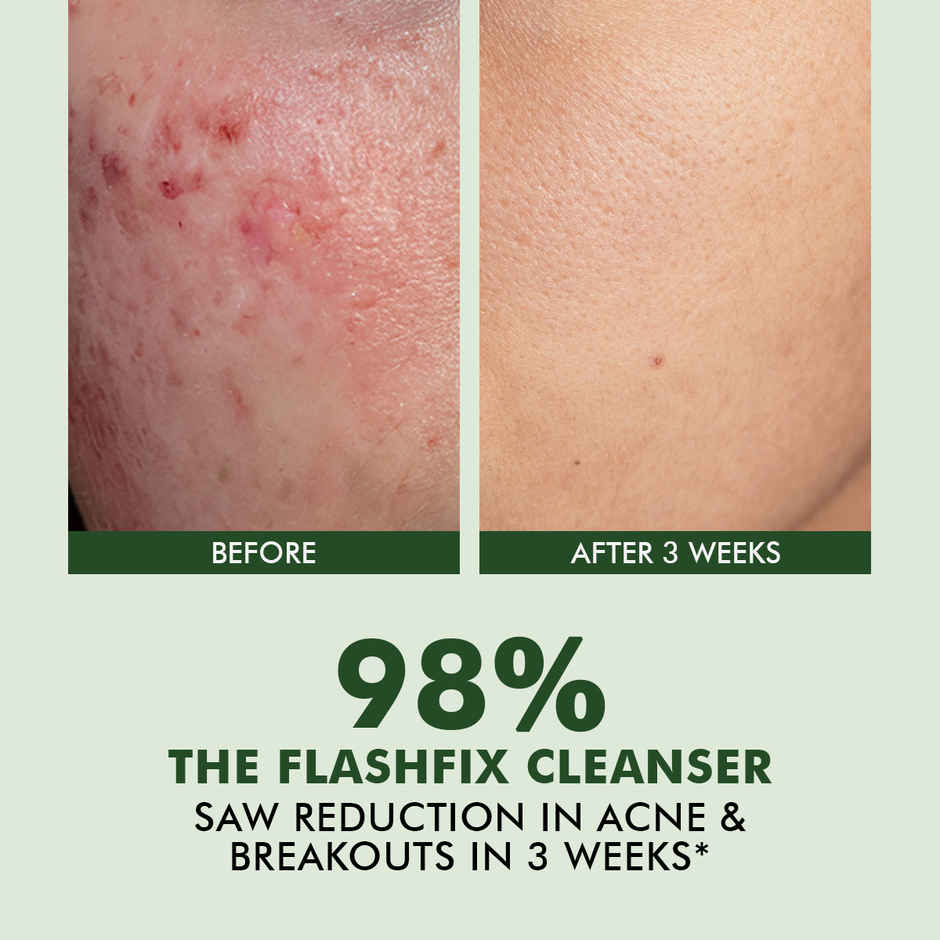 Conscious Chemist Salicylic Acid Face Wash For Oily Acne Prone Skin With Glycolic Acid