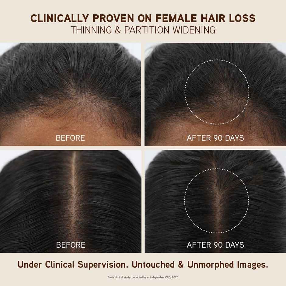Indulekha Bringha Oil | Reduces Hair Fall And Grows New Hair | 100% Ayurvedic Oil