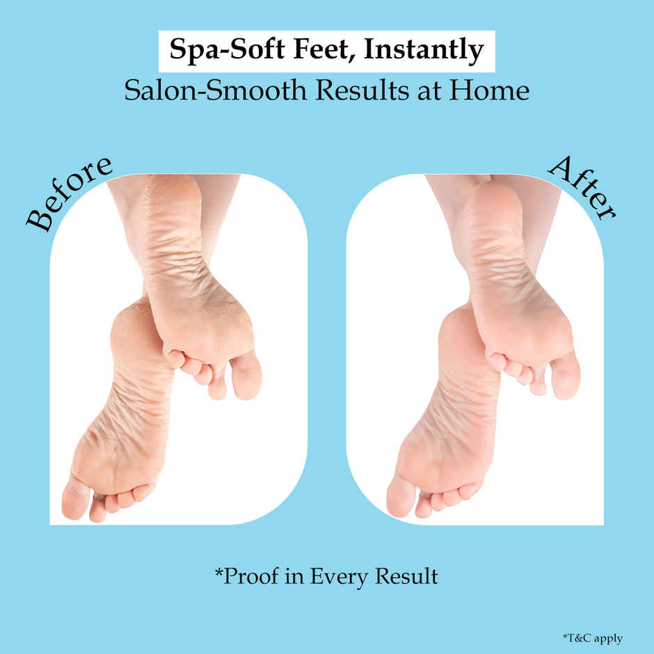Sanfe Pedicure Kit At Home Foot Spa & Callus Care