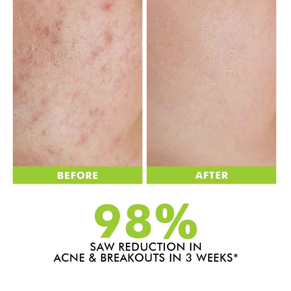 Conscious Chemist Flashfix Acne Spot Corrector Face Cream With 2% Salicylic Acid & Bio-Actives