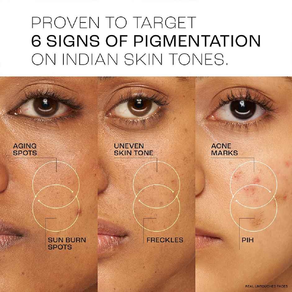 Lakme Perfect Radiance Pigmentation Treatment Gel With 10% Niacinamide Resorcinol Complex