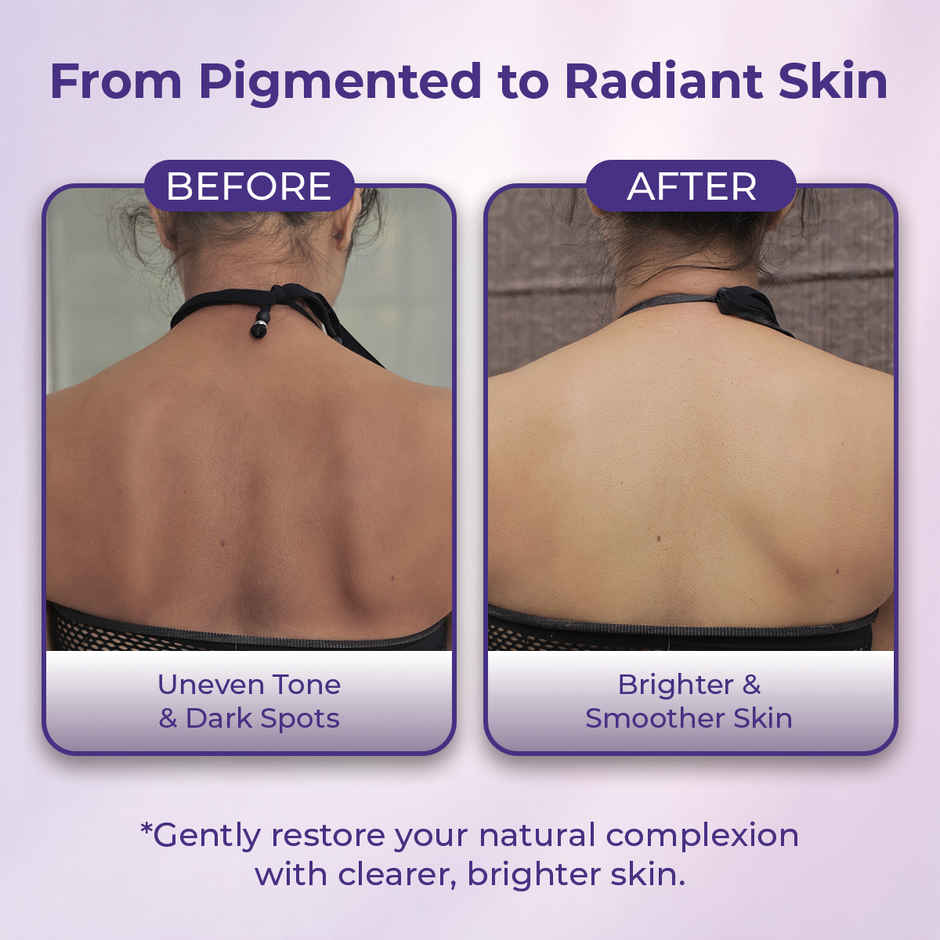 Sanfe Dark Spots Brightening 2% Kojic Acid Body Soap | Skin Whitening, Tan Removal Combo  