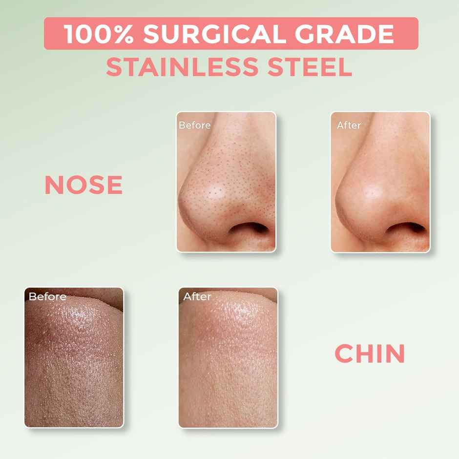 Sanfe Prolume Black head remover