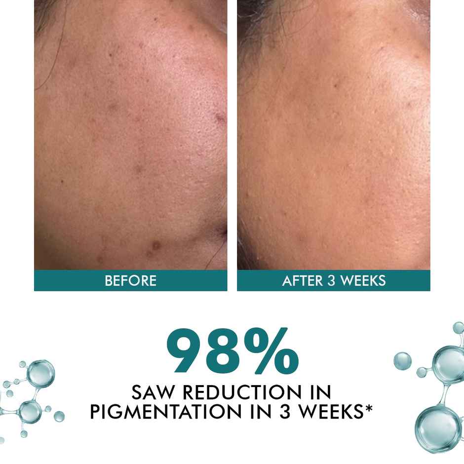 Conscious Chemist Niacinamide Pigmentation Corrector Night Cream Moisturiser For Dark Spots