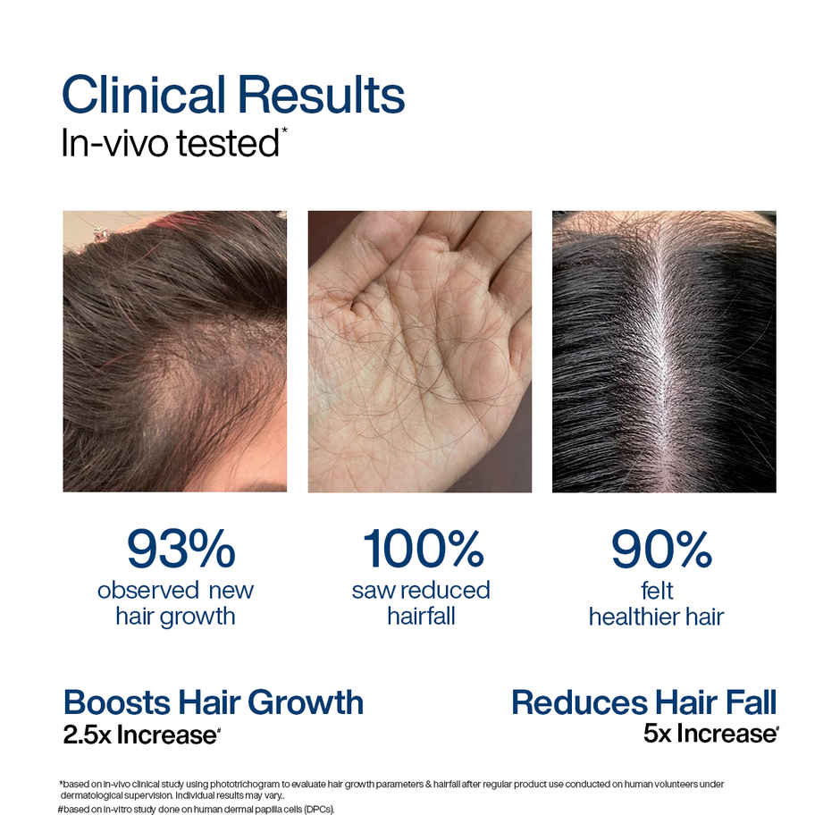 WishCare Hair Growth Serum Concentrate | New Hair Growth in 8 weeks | Redensyl, Anagain & Rosemary