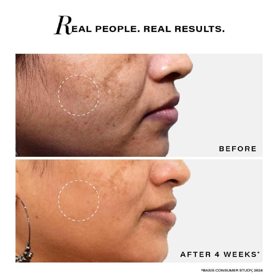 Novology Pigmentation Serum | Bi-Phasic Face Serum For Hyperpigmentation And Dark Spots