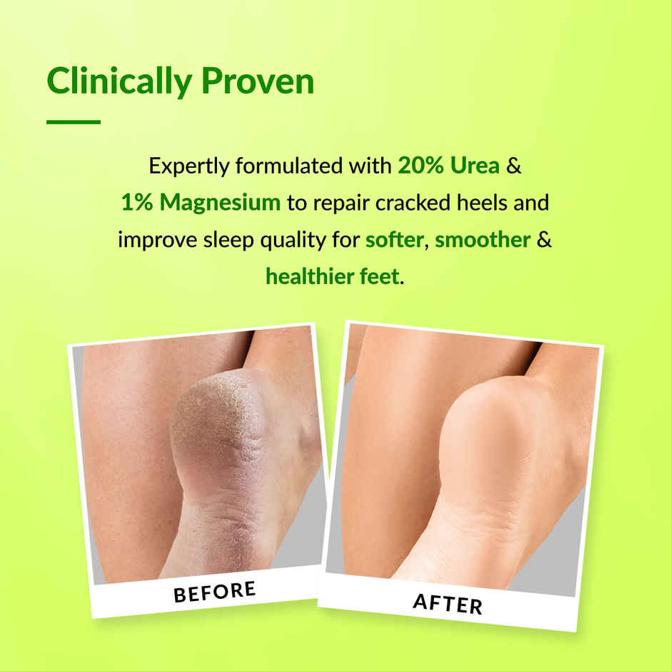 Fixderma Foobetik Foot Roll On For Dry & Cracked Heels with Urea, Lactic Acid & Magnesium