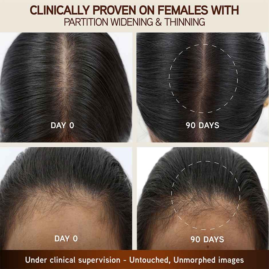 Indulekha Bringha Hair Growth Treatment Scalp Serum |Ayurvedic Hair Growth Serum