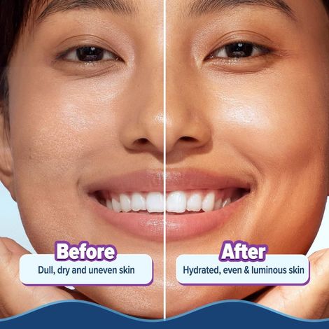 Aqualogica Illuminate + Hydra Gel Moisturizer With Alpha Arbutin For 24 Hour Intense Hydration