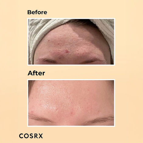 Cosrx Advanced Snail 96 Mucin Power Essence