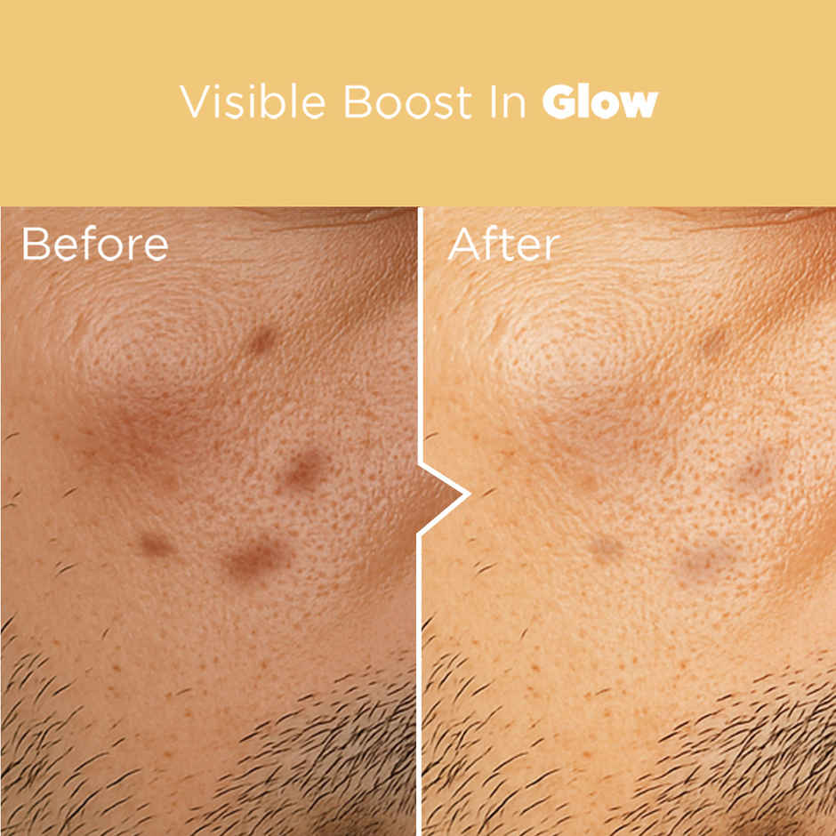 The Man Company Vitamin C Face Serum | With Hyaluronic acid| Evens skin tone & boosts collagen | For all skin types