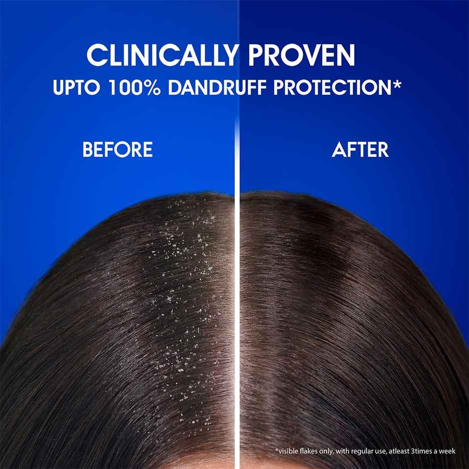 Head & Shoulders, Anti-Hairfall, Anti-Dandruff Shampoo for Women & Men Combo