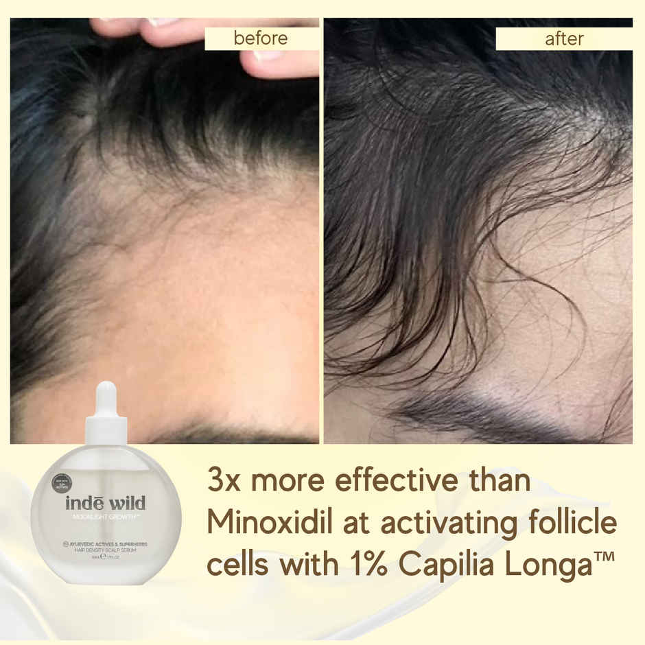 inde wild Moonlight Scalp Serum with Moringa, Bhringraj & Amla | Healthy Scalp & Hair Density