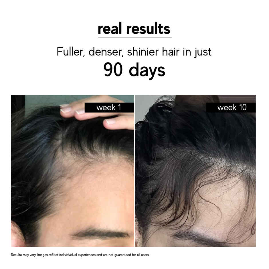 inde wild Moonlight Scalp Serum with Moringa, Bhringraj & Amla | Healthy Scalp & Hair Density