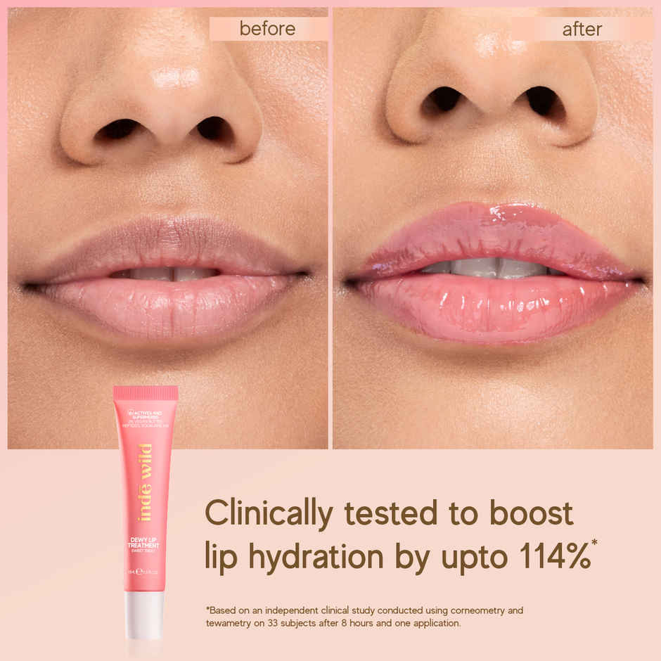 inde wild Dewy Lip Treatment | Sweet Treat
