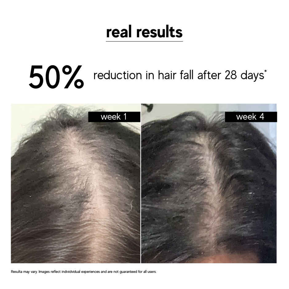 inde wild Champi Hair Oil With Bhringraj, Brahmi & Amla For Regrowth, Hairfall & Dandruff Control