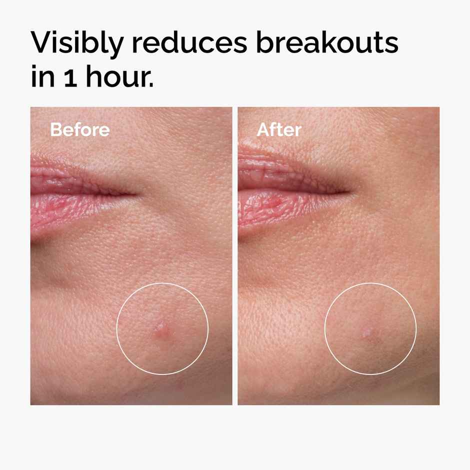 The Ordinary Sulfur 10% Powder-to-Cream Concentrate - IN