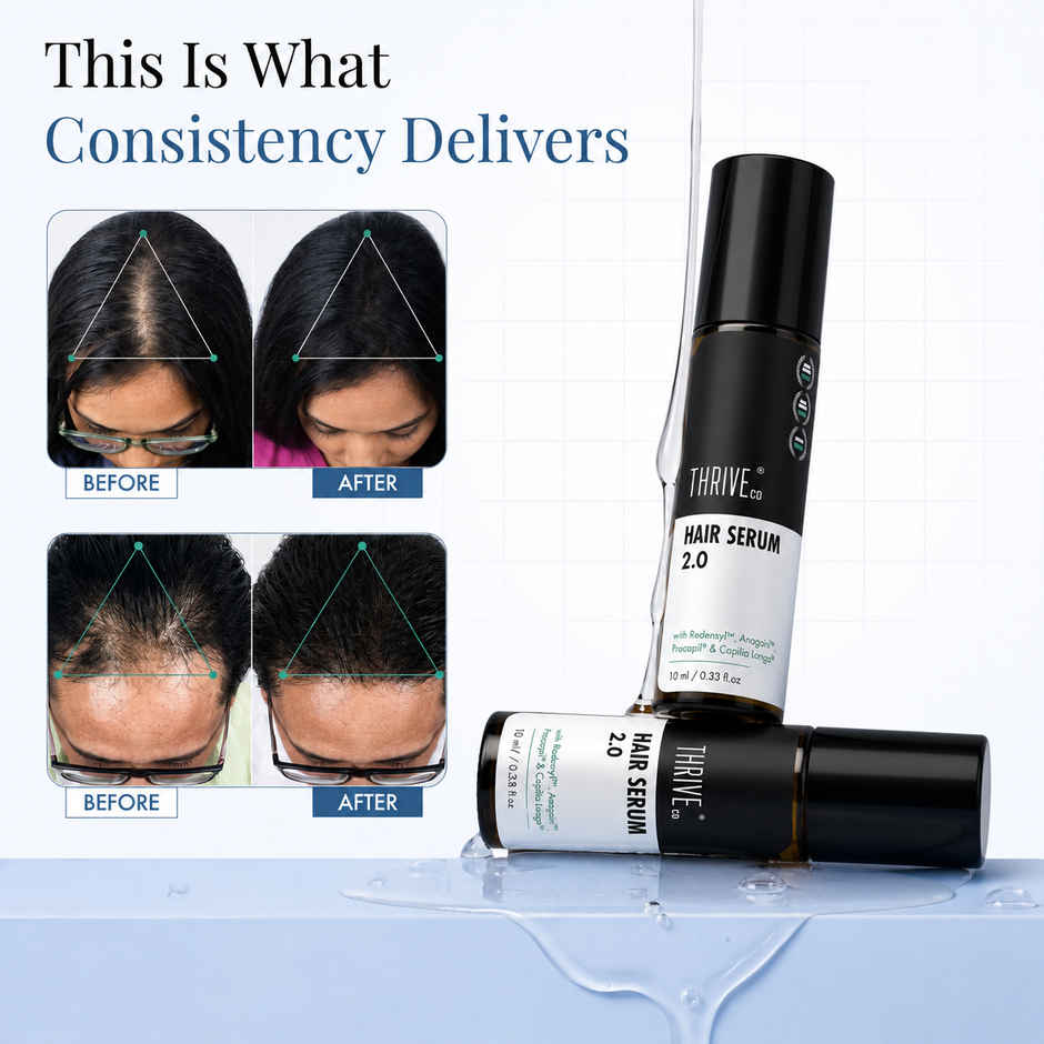 Thriveco Hair Growth Serum 2.0 - For Hair Growth & Hair Fall Control | Men & Women