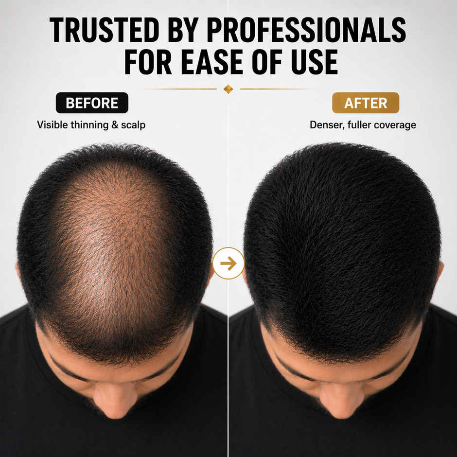 EleGanz Professional Hair Building Fibers | Hair Fiber Powder for Bald Spots & Thinning Hair