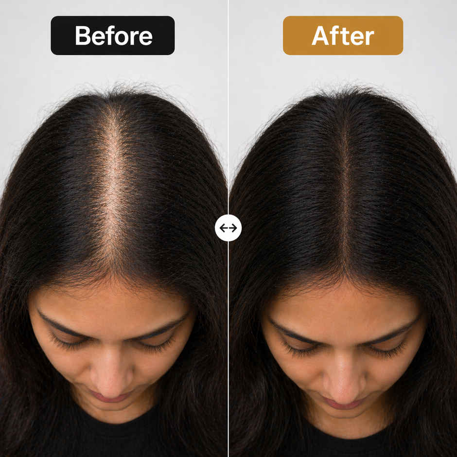 EleGanz Professional Hair Building Fibers | Hair Fiber Powder for Bald Spots & Thinning Hair