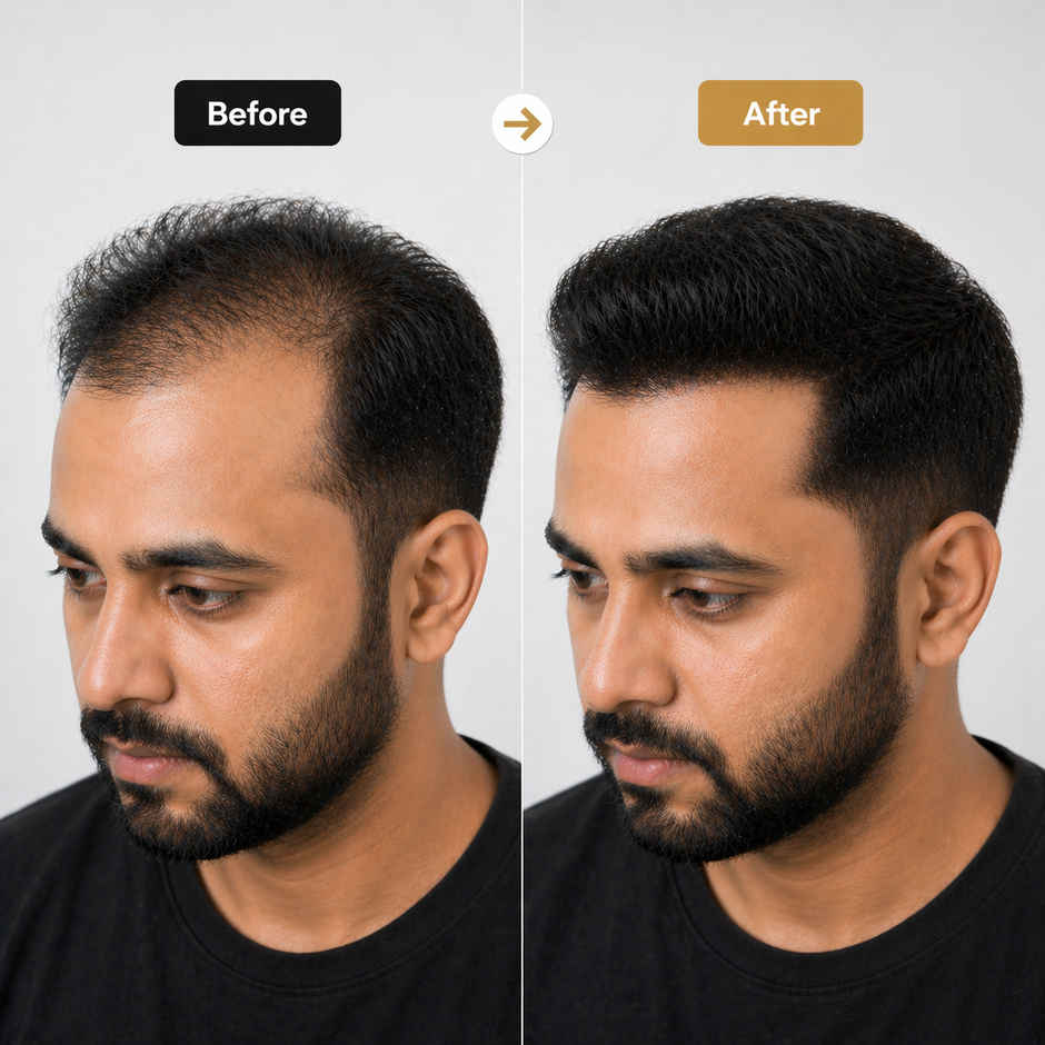 EleGanz Professional Hair Building Fibers | Hair Fiber Powder for Bald Spots & Thinning Hair