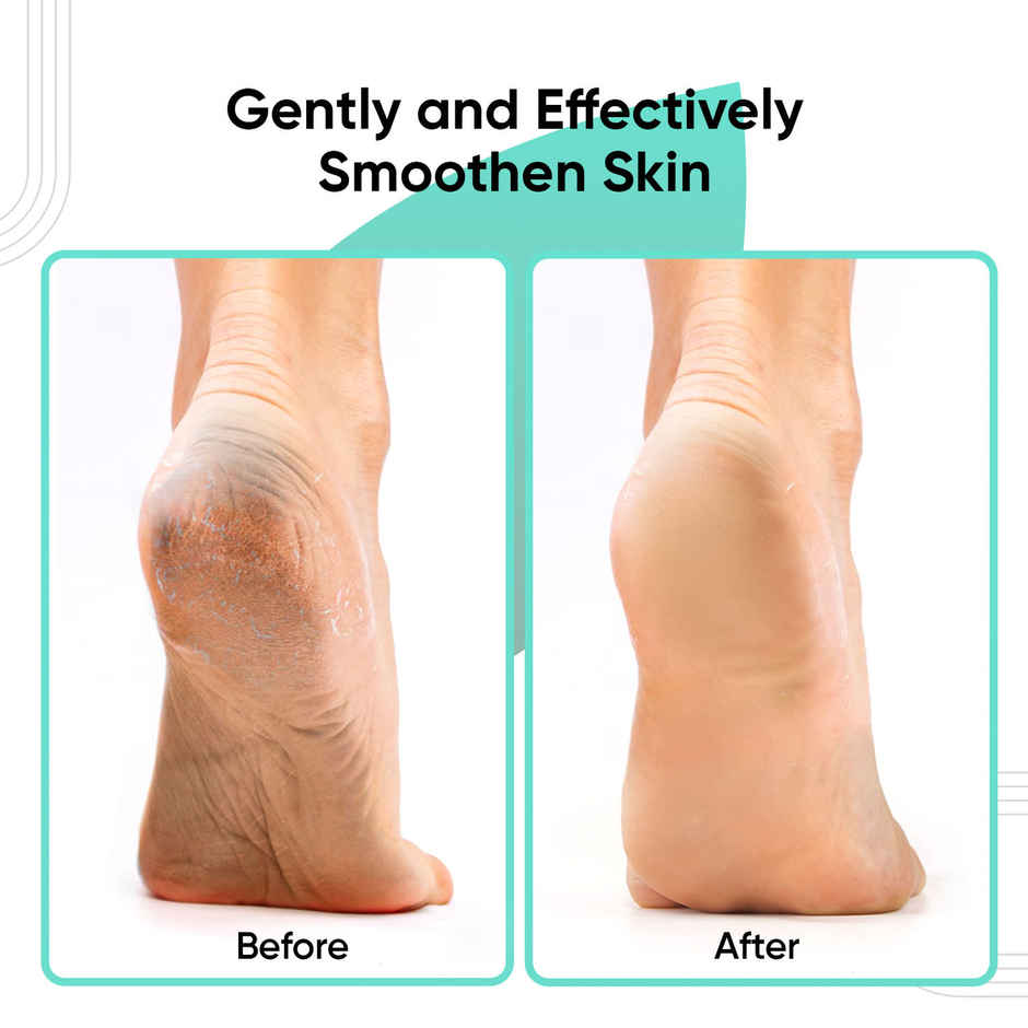 VEGA Oval Shaped Pumice Stone for Feet Dead Skin Removal | PD-16