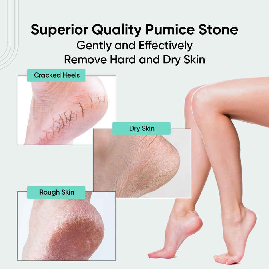 VEGA Oval Shaped Pumice Stone for Feet Dead Skin Removal | PD-16