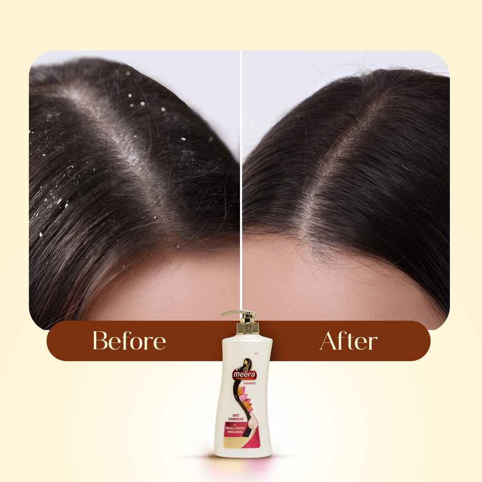 Meera Anti Dandruff Shampoo With Small Onion and Fenugreek