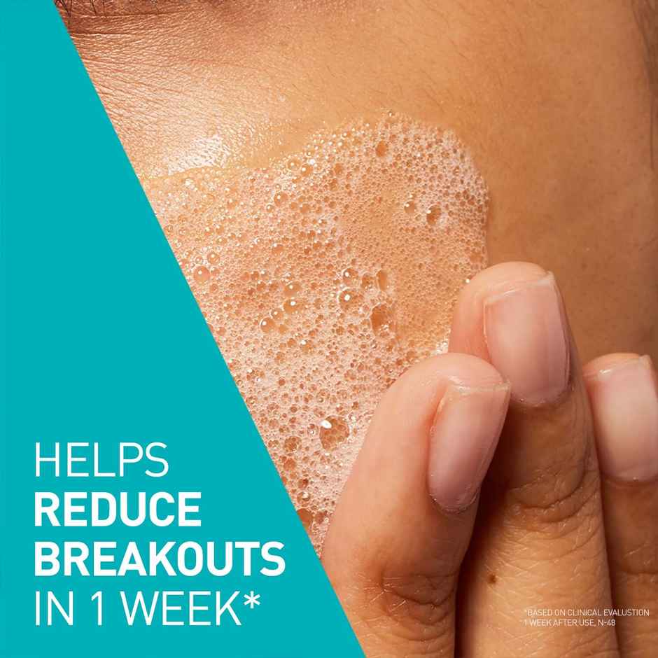 Cerave Blemish Control Cleanser With 2% Salicylic Acid & Niacinamide For Acne-Prone Skin