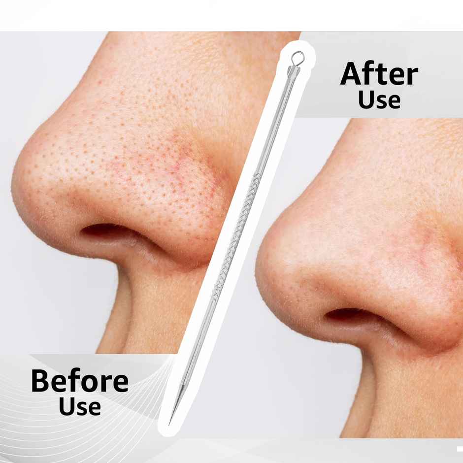 VEGA Black Head Remover | Pointed | BHR-01