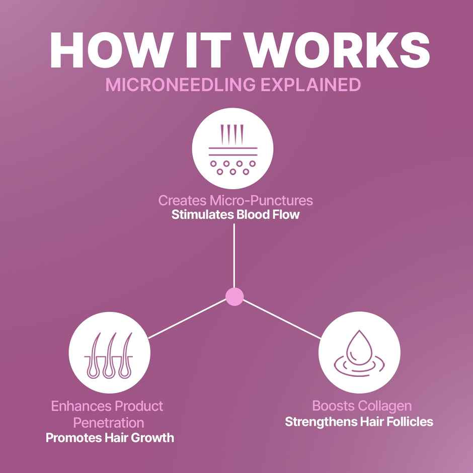 Sotrue Derma Roller 0.5 mm with 540 Stainless Steel Needles | Free Sanitizer 50ml